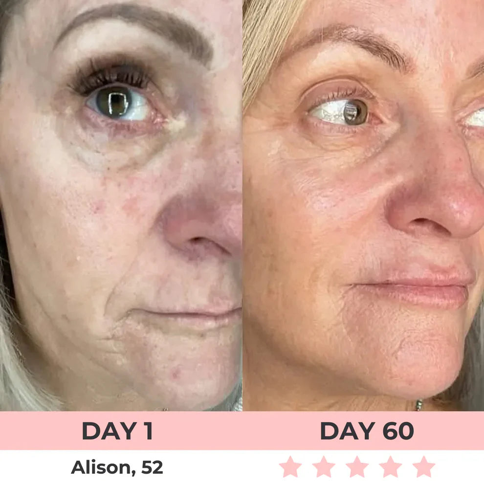 7-in-1 LED Facial Sculptor